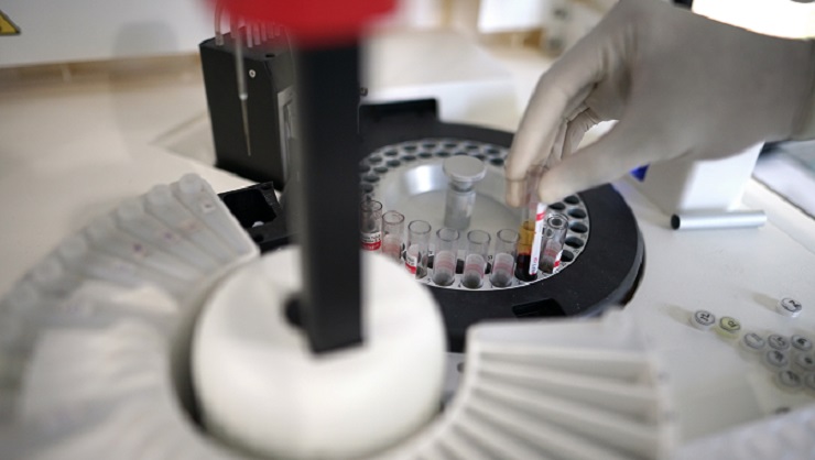 Samples in vials testing in a lab